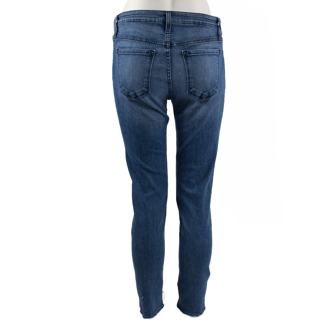 Exposed Button Ankle Skinny - Denny's